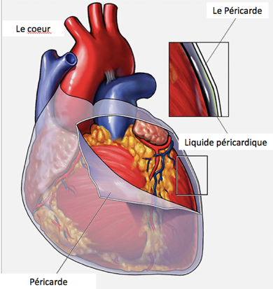 Péricardectomie - Chirurgie cardiaque - Clinique Saint-Augustin ...