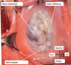 Anatomie de la valve tricuspide